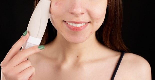 How Long Do Pore Vacuum Bruises Last
